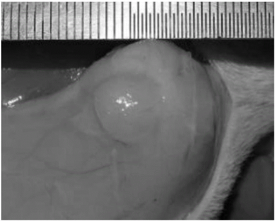 Mixed hyaluronic-acid gel and preparation method thereof