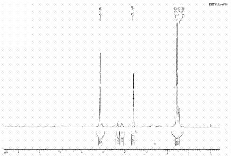 Injectable temperature-sensitive hydrogel and preparation method thereof