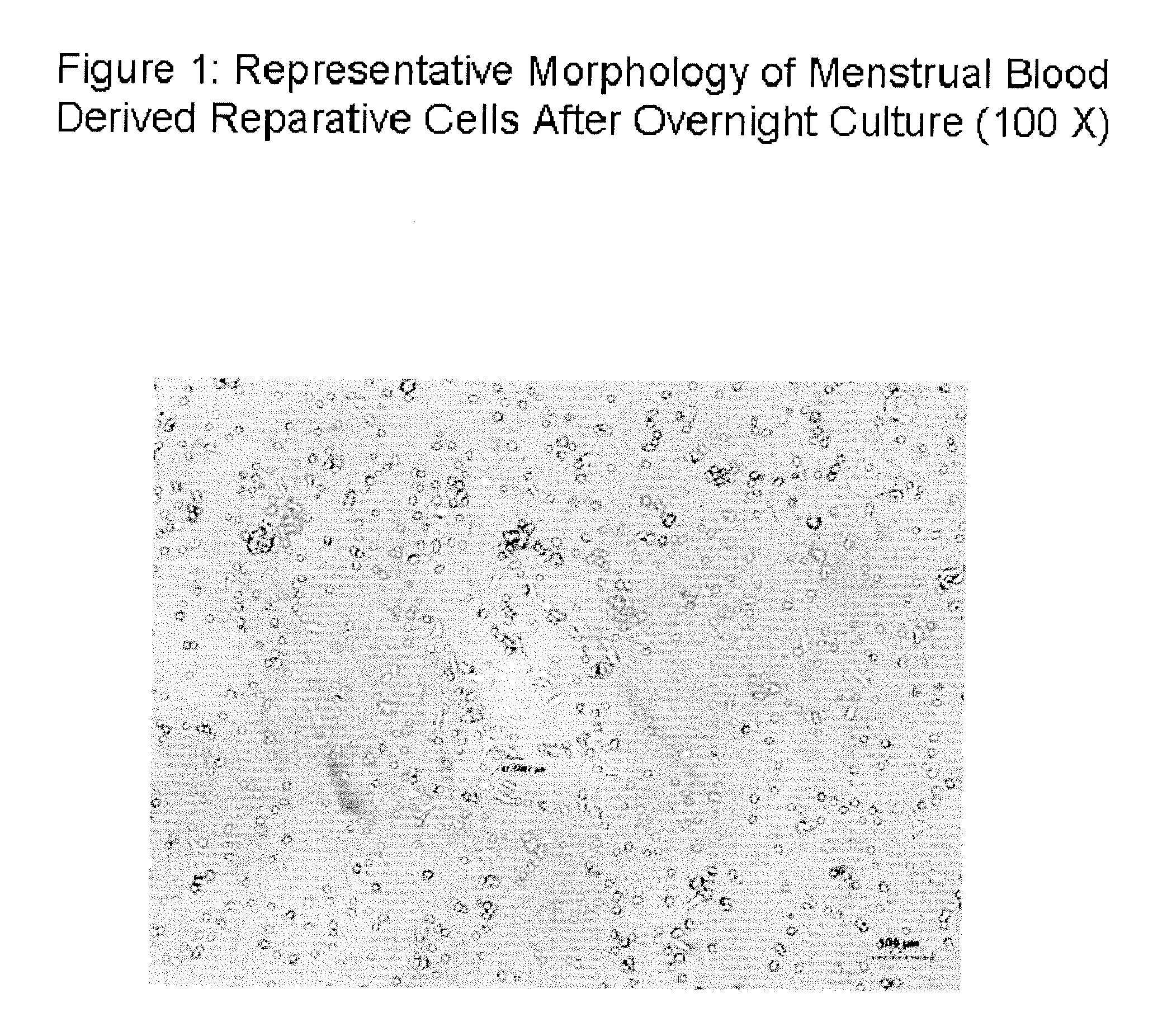 Endometrial stem cells and methods of making and using same