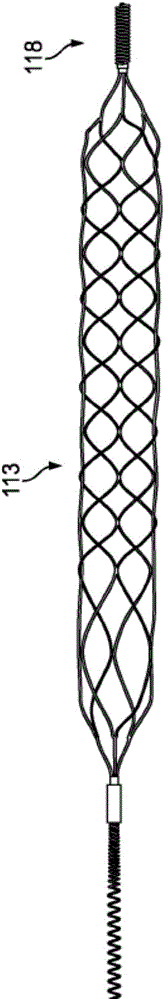 Blood flow restriction apparatus and method for embolus removal in human vasculature