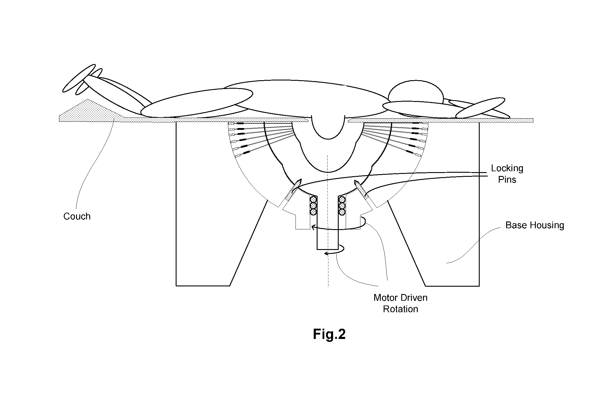 Method and equipment for image-guided stereotactic radiosurgery of breast cancer