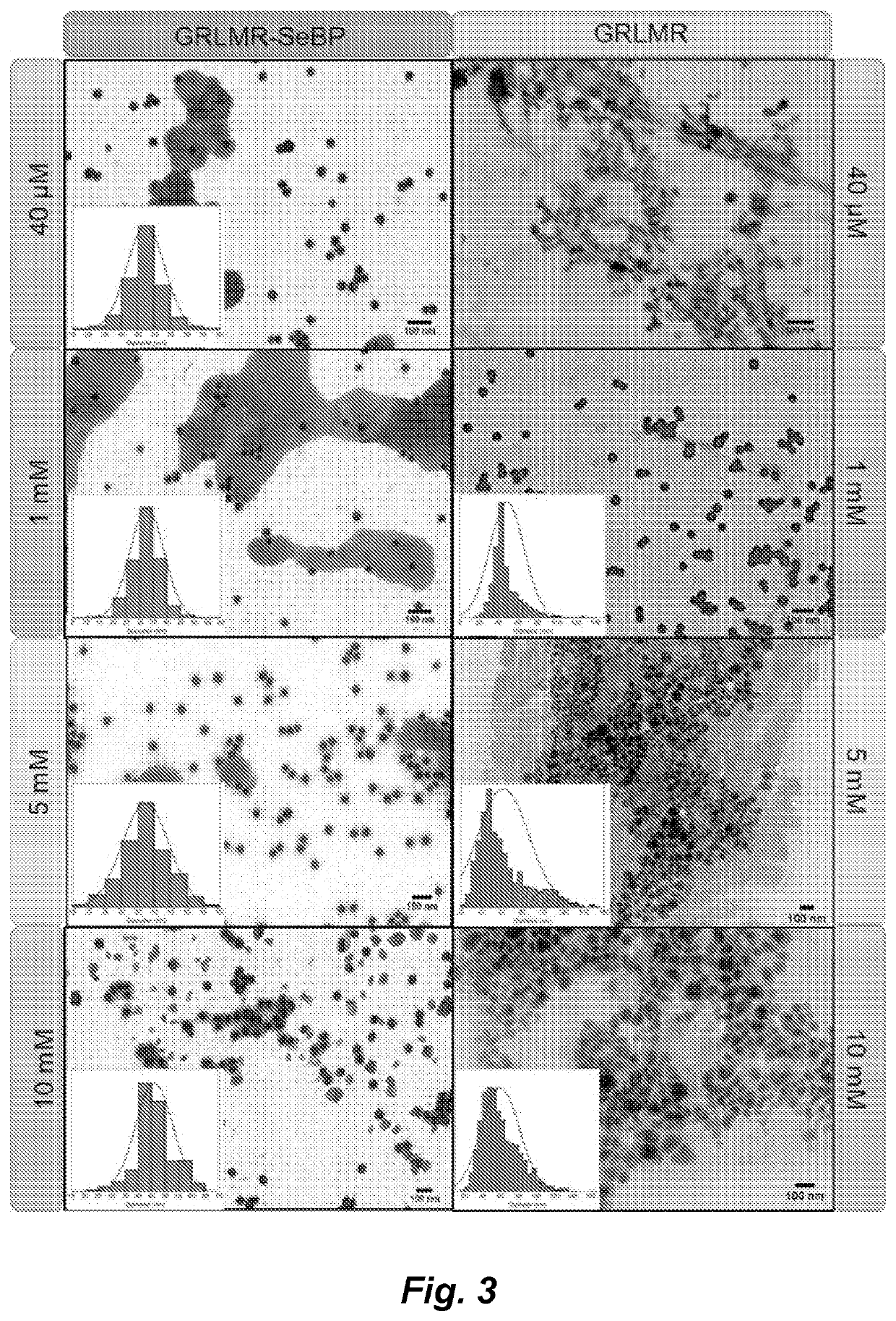 A metal-reducing enzymatic tag for optical and electron microscopy