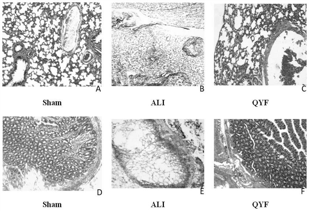 Traditional Chinese medicine composition for treating acute lung injury as well as preparation method and application thereof