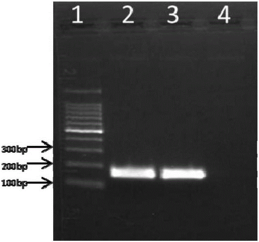 A kit and method for detecting human parvovirus b19