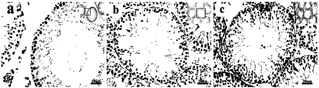 Application of retinoic acid in preparation of drugs for improving prognosis of cryptorchidism