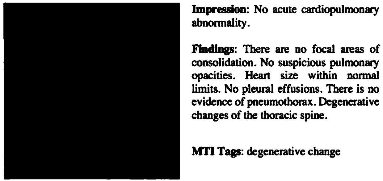 Method for automatically generating medical image diagnosis report based on deep learning method