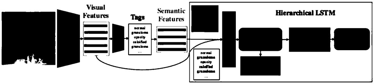 Method for automatically generating medical image diagnosis report based on deep learning method