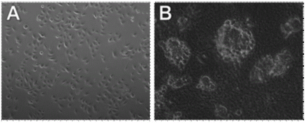 Prostate extracellular matrix gel for cultivating prostate cells