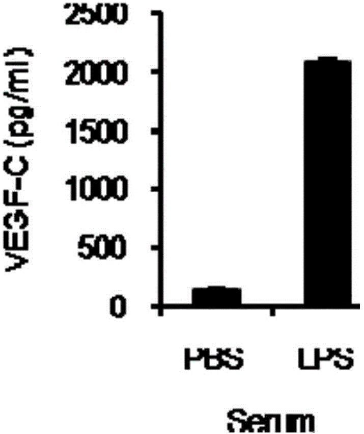 Use of VEGF-C in preparation of sepsis and severe bacterial infection diagnosis reagent