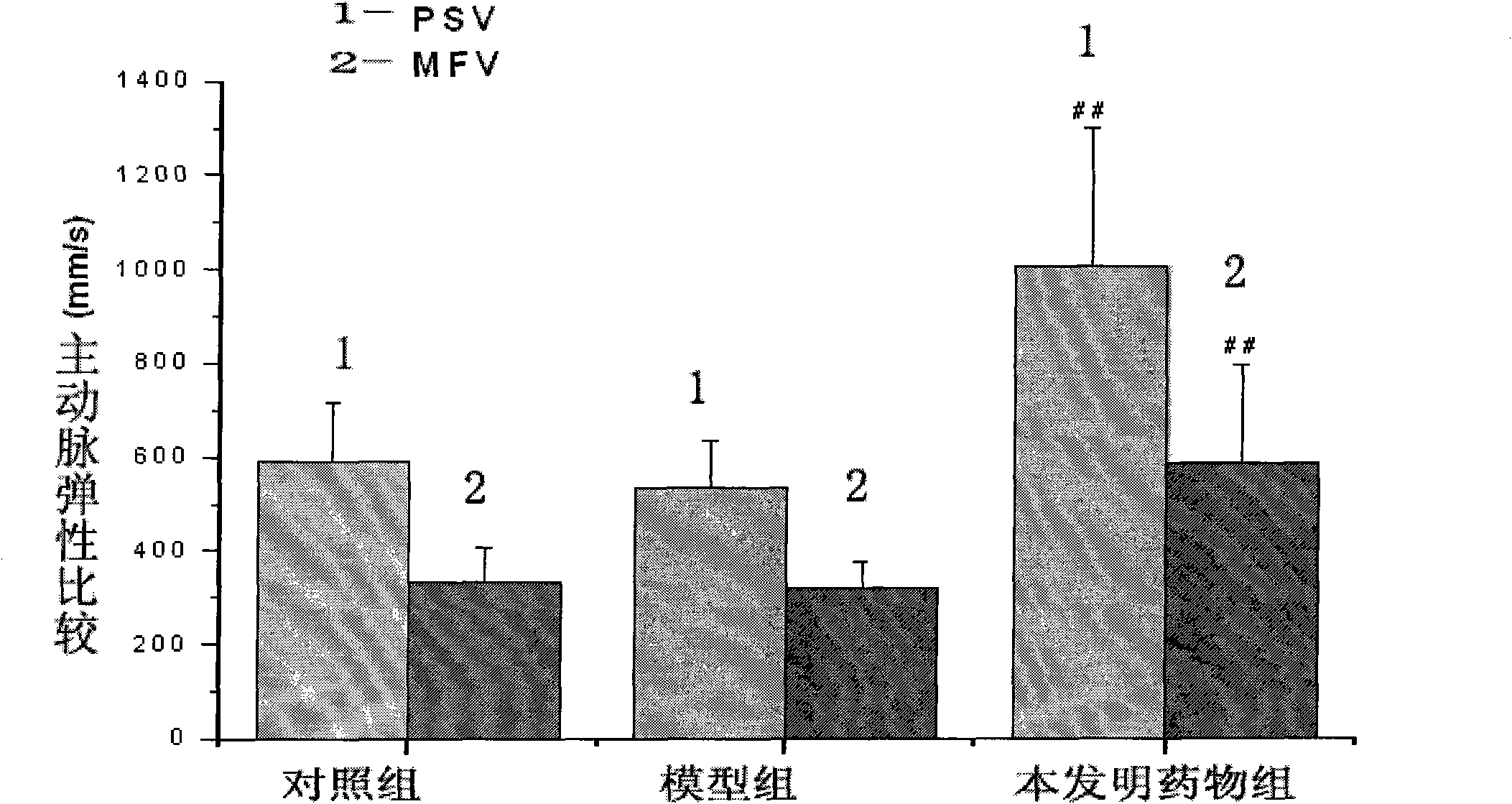 Application of traditional Chinese medicinal composition to preparation of medicaments for improving hypercholesterolemia-induced cardiac dysfunction