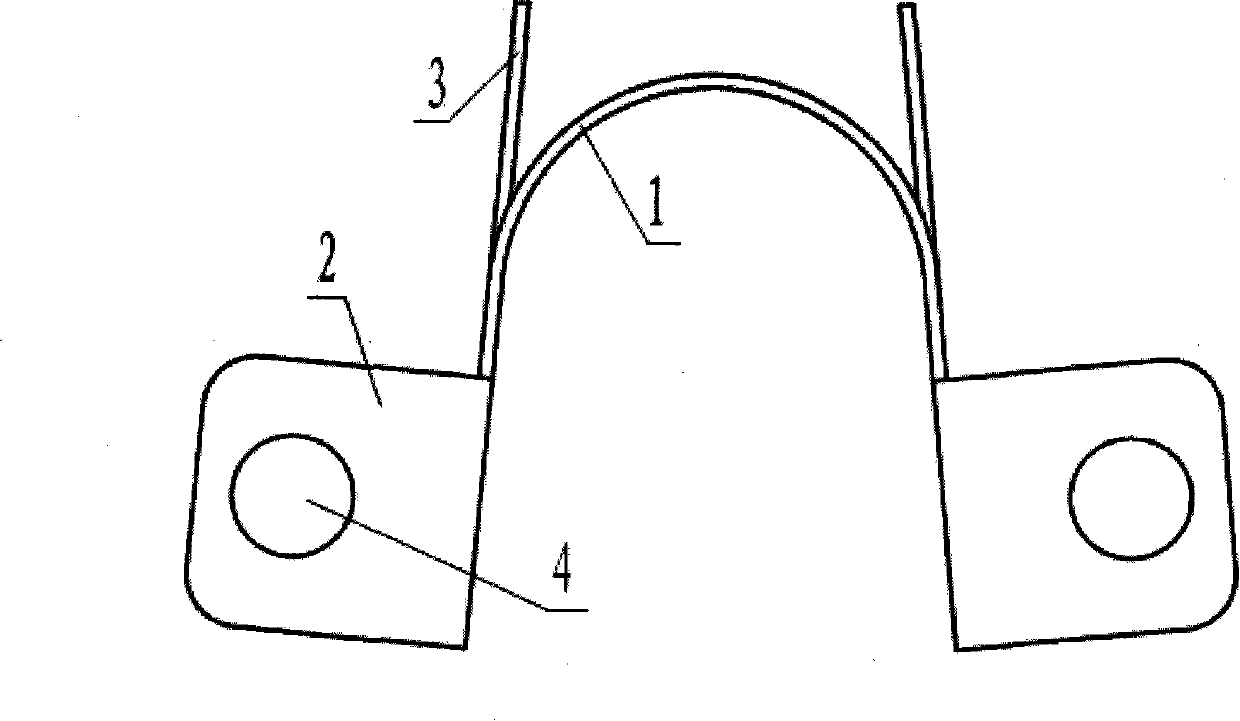 Spinal crest elastic internal fixation device