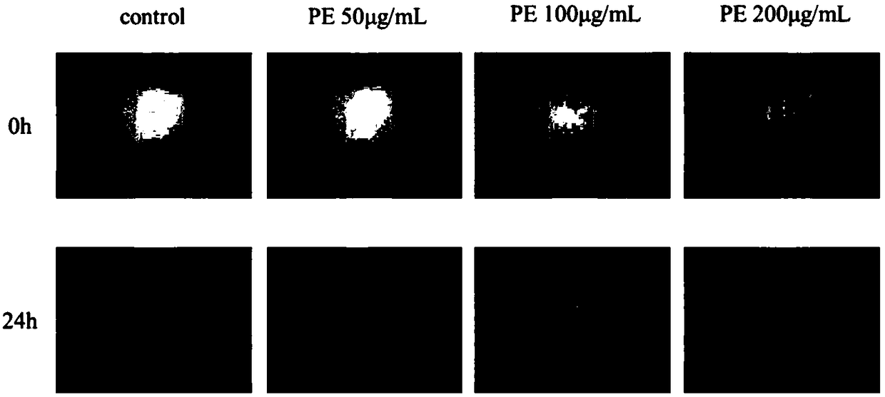 Application of pedunculoside in preparing anti-diabetic skin ulcer drug and pharmaceutical composition for treating diabetic skin ulcers.