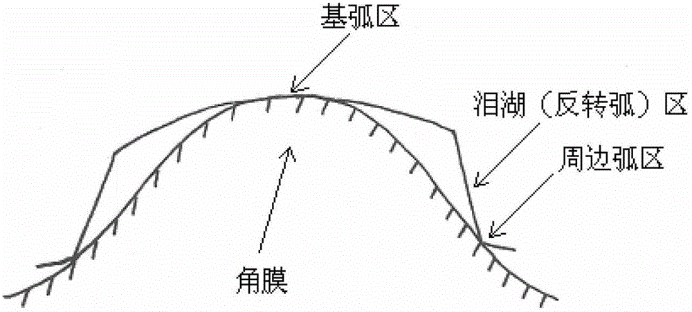 Orthokeratology lens