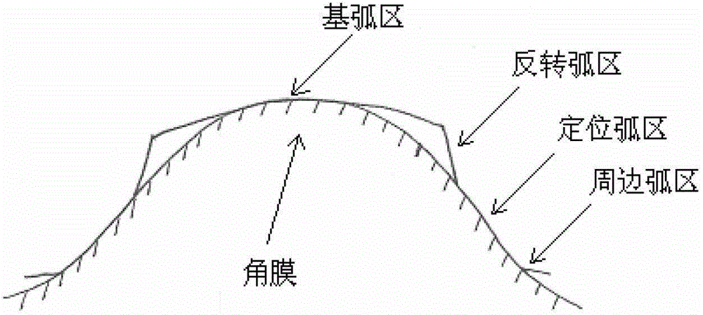 Orthokeratology lens