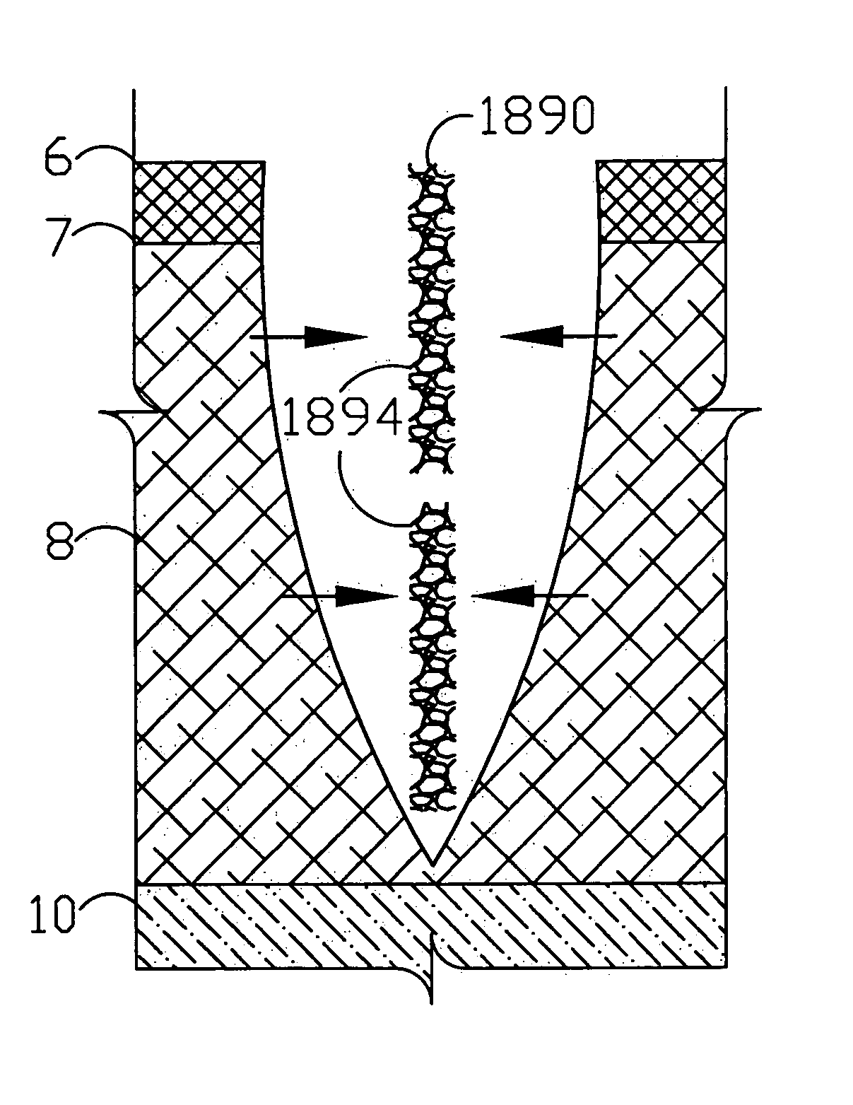 Flexible medical closure screen and method