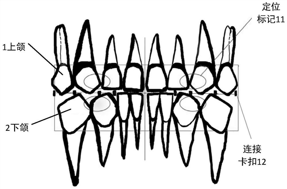 Maxillofacial surgery auxiliary system and method based on MR head-mounted device