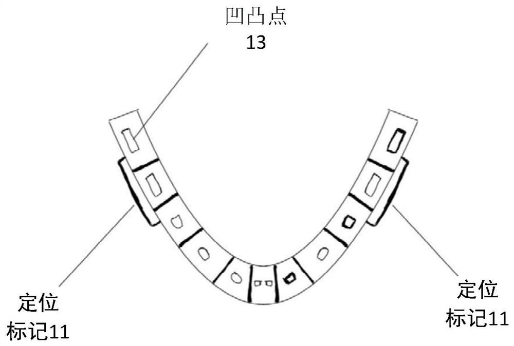 Maxillofacial surgery auxiliary system and method based on MR head-mounted device