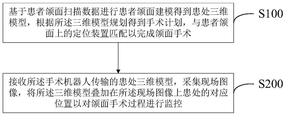 Maxillofacial surgery auxiliary system and method based on MR head-mounted device