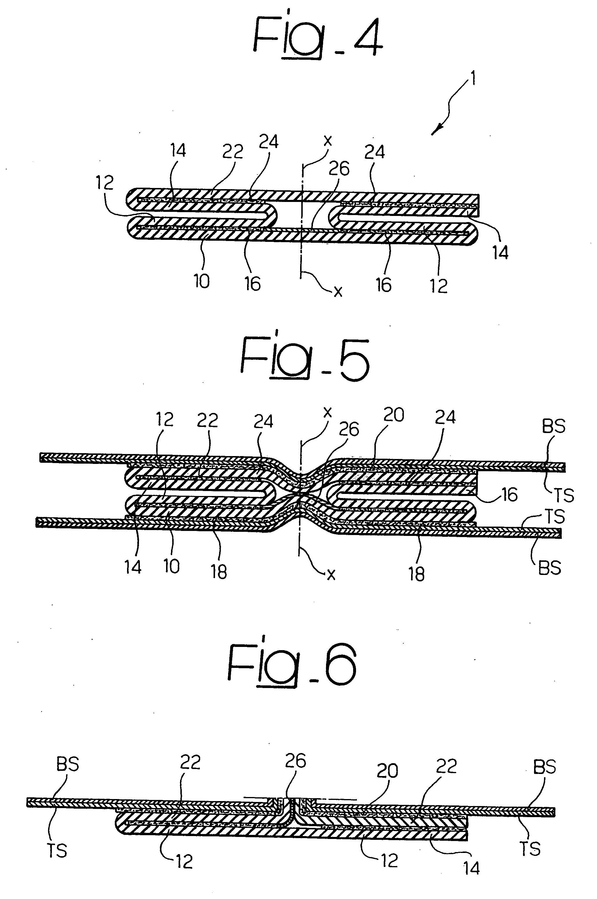 Closure element for absorbent sanitary products, manufacturing process, process of use, and product thus obtained