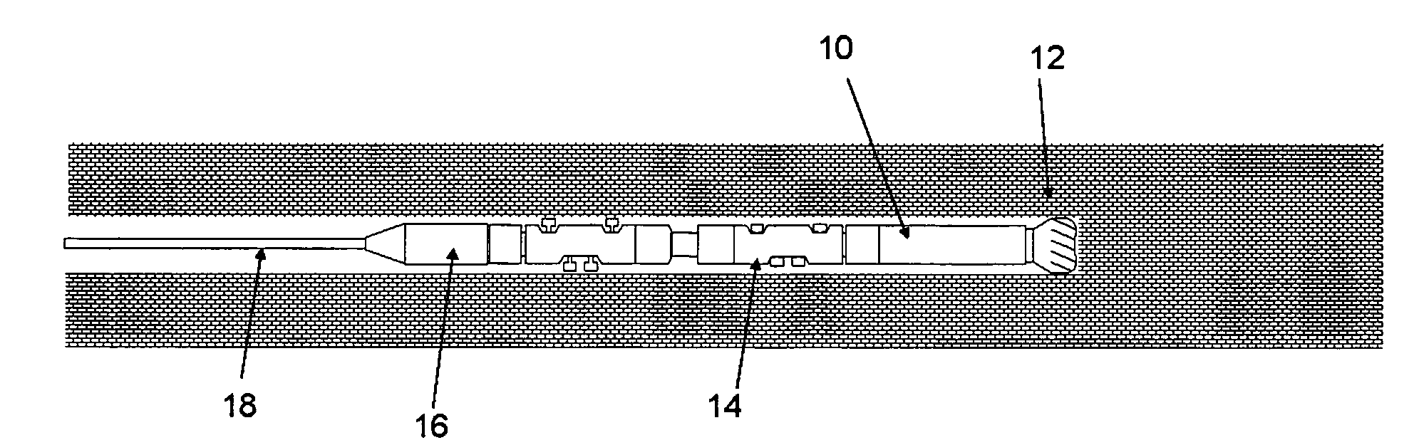 Drilling System