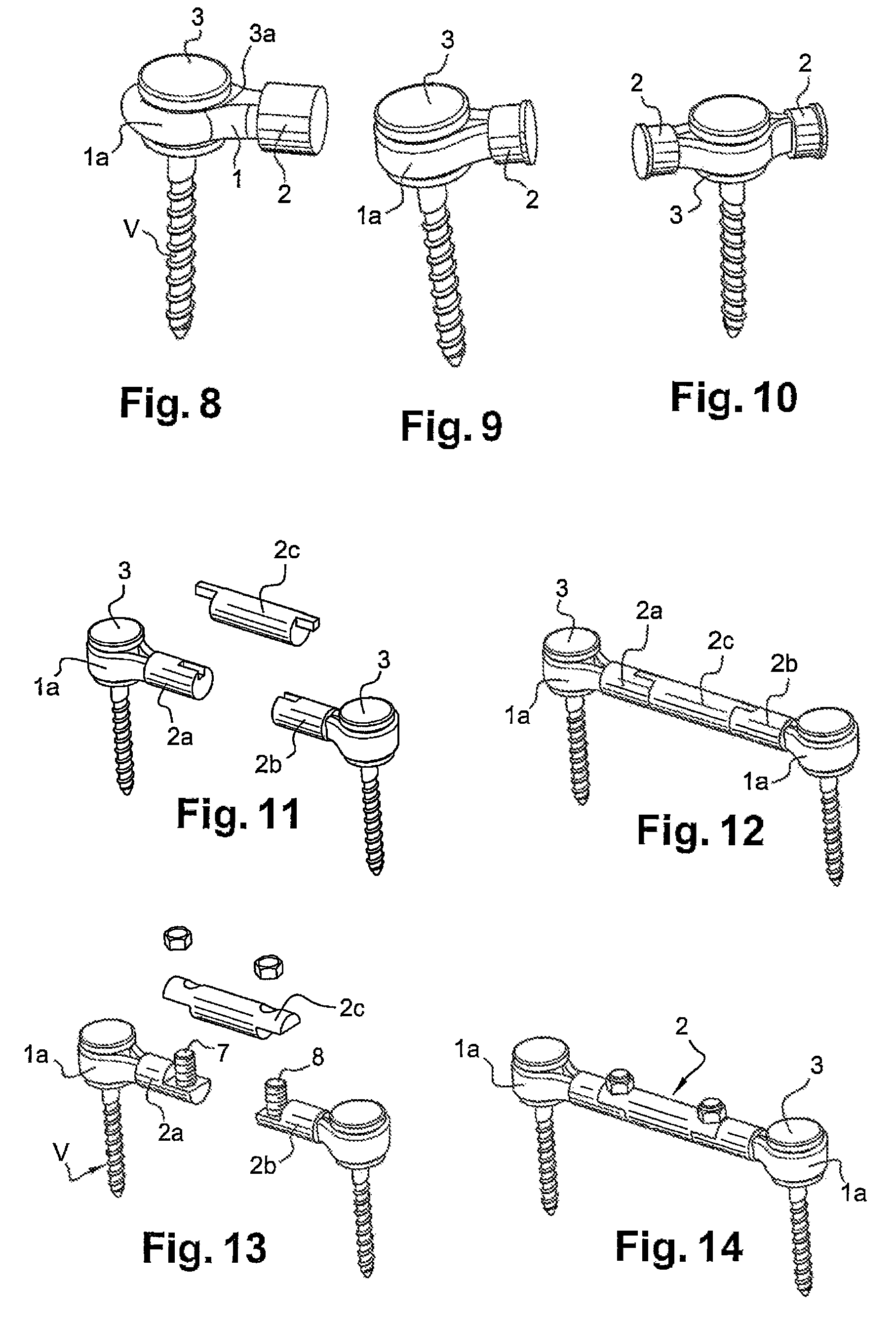 Extra-discal intervertebral stabilization device