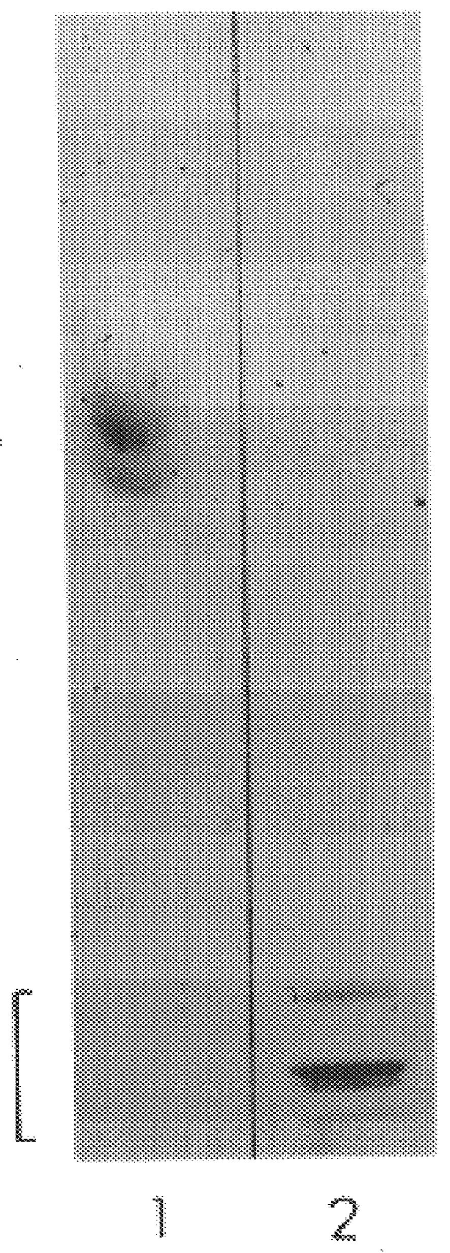 Autoantibodies and their targets in the diagnosis of peripheral neuropathies