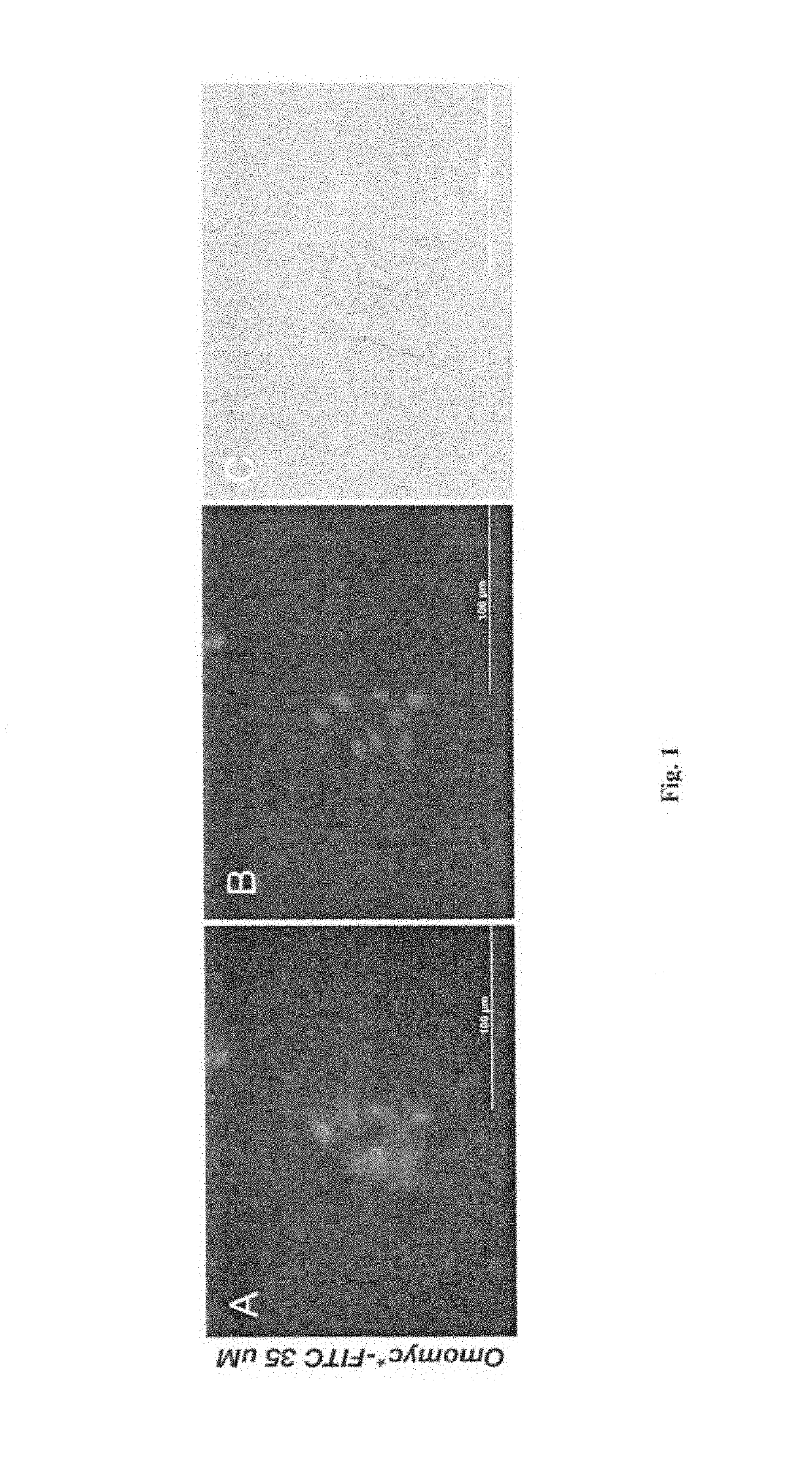 Methods and compositions for the treatment of cancer