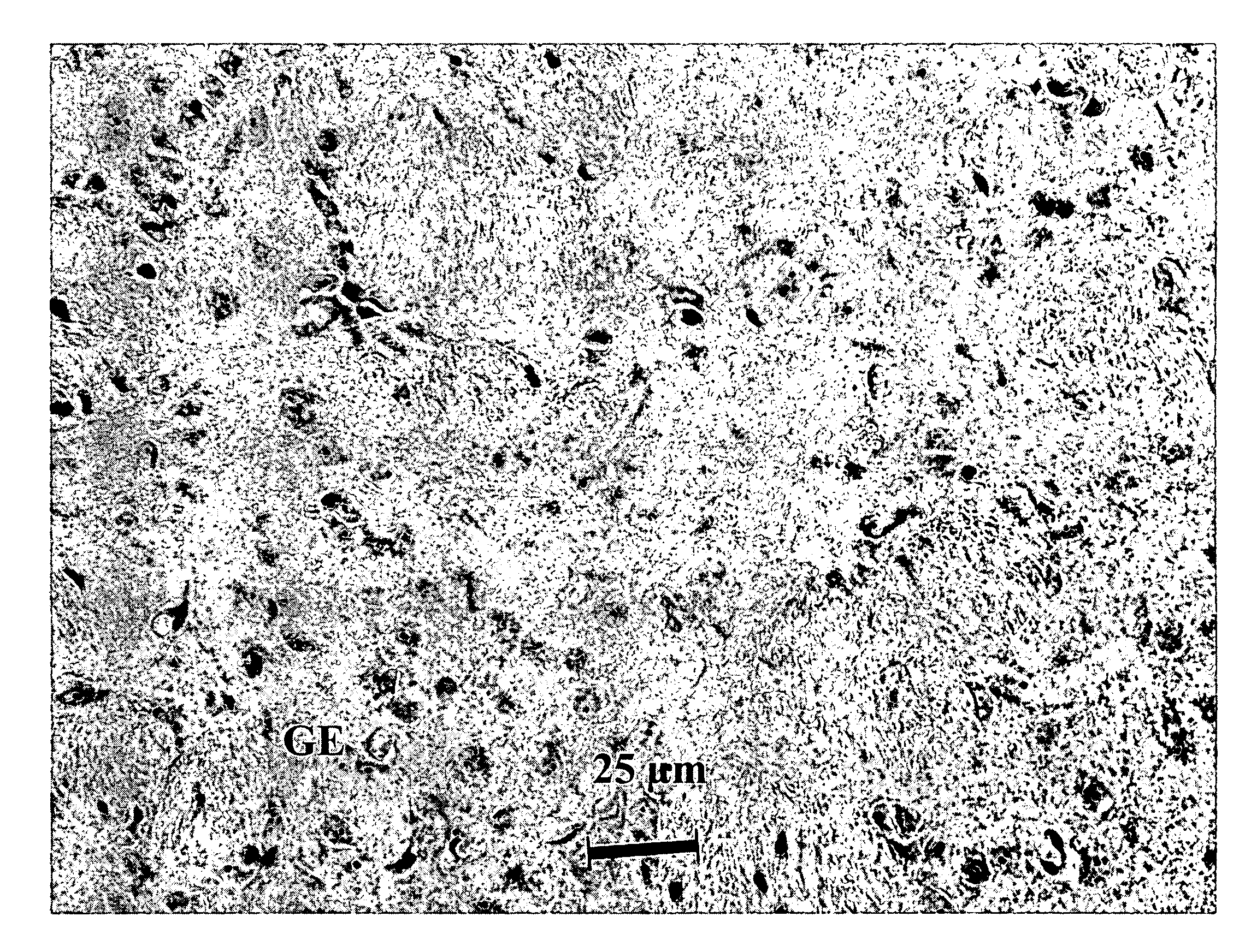 Method of making and using an adenosine analogue