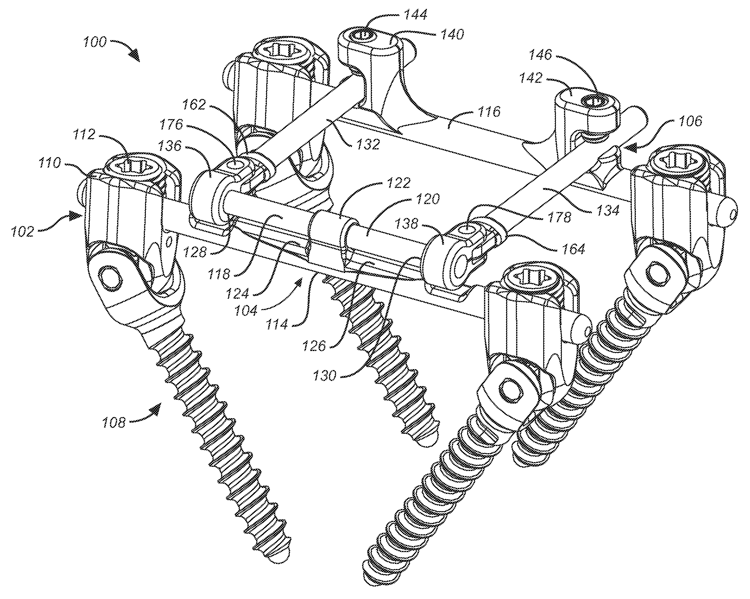 Dynamic stabilization and motion preservation spinal implantation system and method with a deflection rod