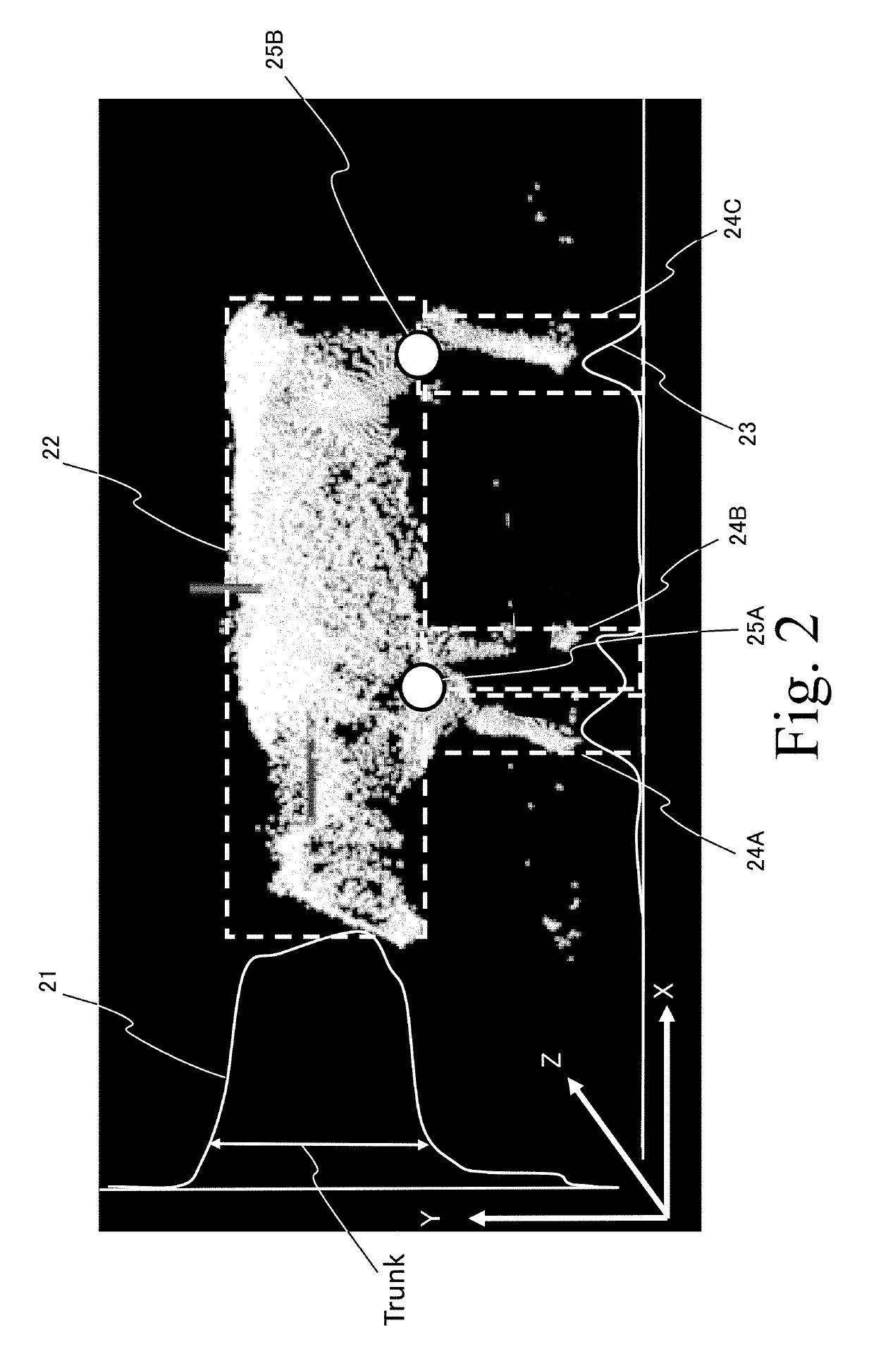 Health condition estimation device