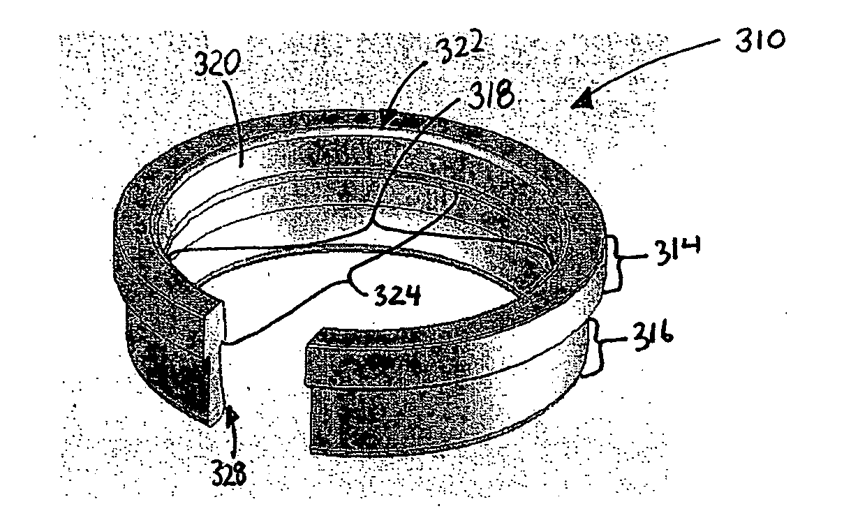 Side-biased orthopedic fastener retention