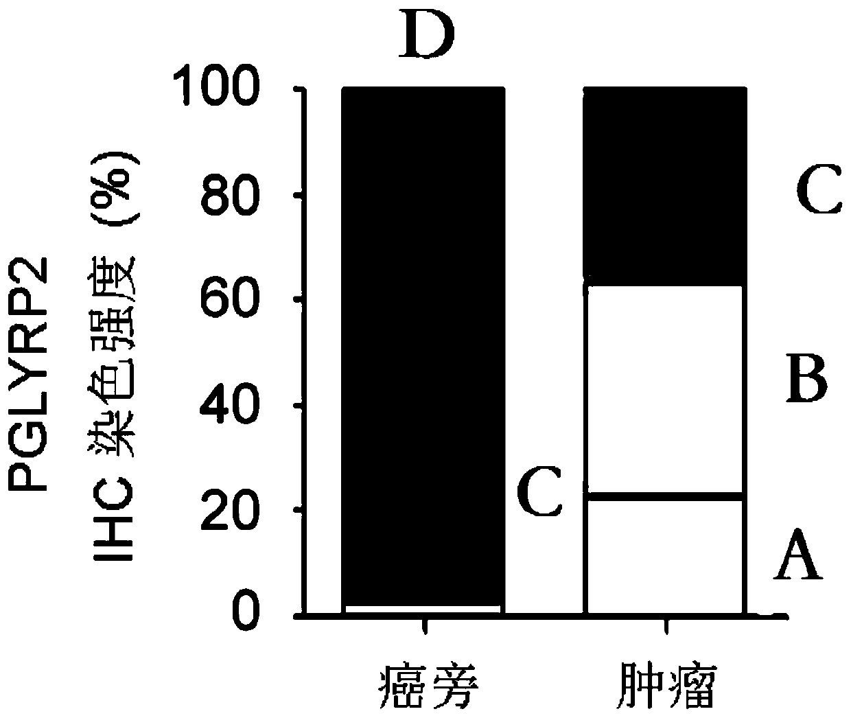 Tumor immune biomarker and application thereof