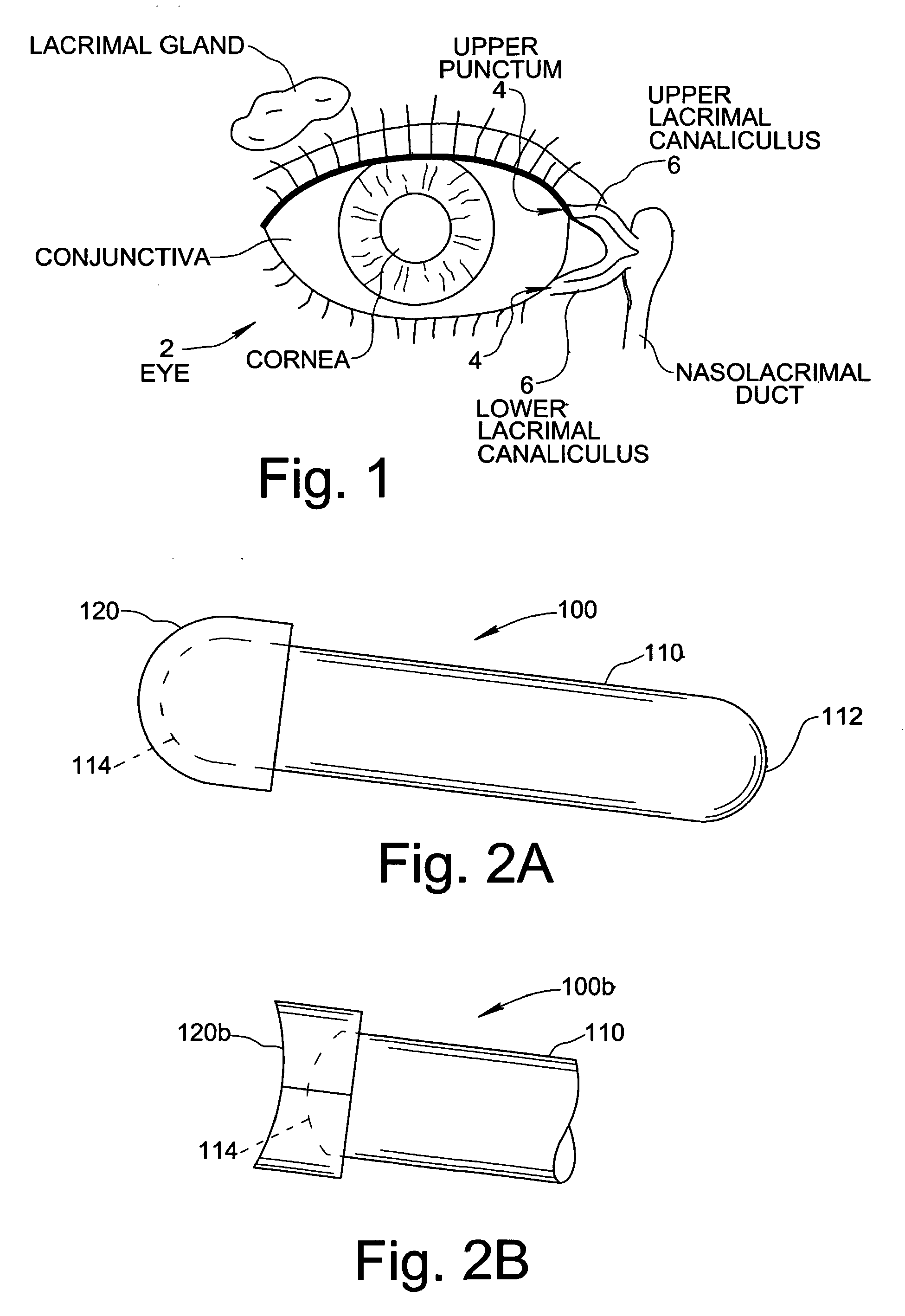 Treatment Medium Delivery Device and Methods for Delivery of Such Treatment Mediums to the Eye Using such a Delivery Device