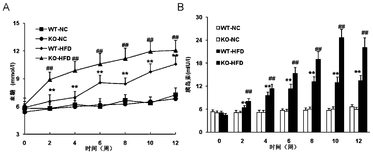 Function and application of dual specificity phosphatase 14 in the treatment of non-alcoholic fatty liver disease and type Ⅱ diabetes