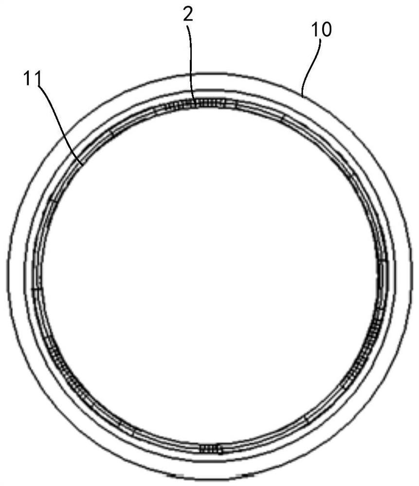 Pulmonary artery support