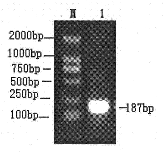 Dual SYBR Green I real-time fluorescence PCR detection primer and method for porcine pseudorabies virus and porcine circovirus type 2