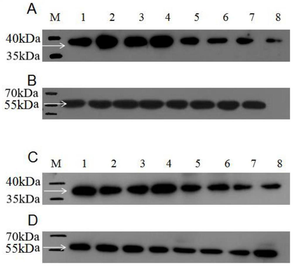 Tea tree anthocyanin reductase protein antigen polypeptide as well as antibody, detection kit and application thereof