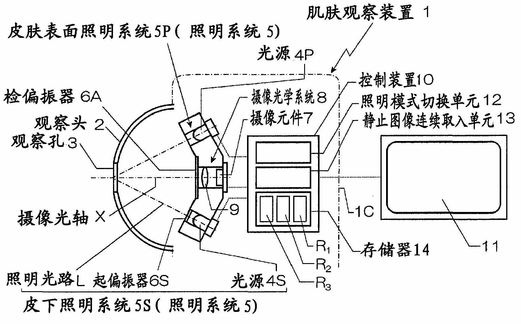 Skin observation device