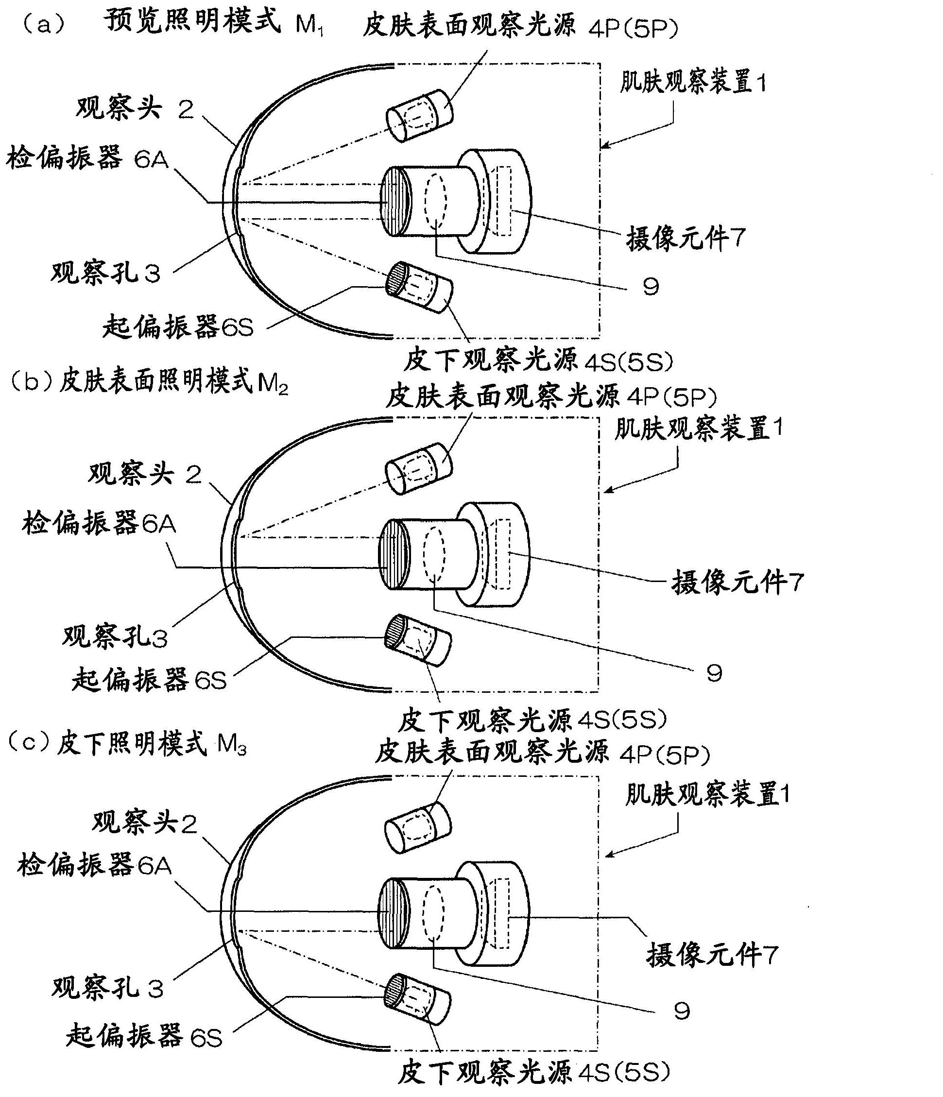 Skin observation device