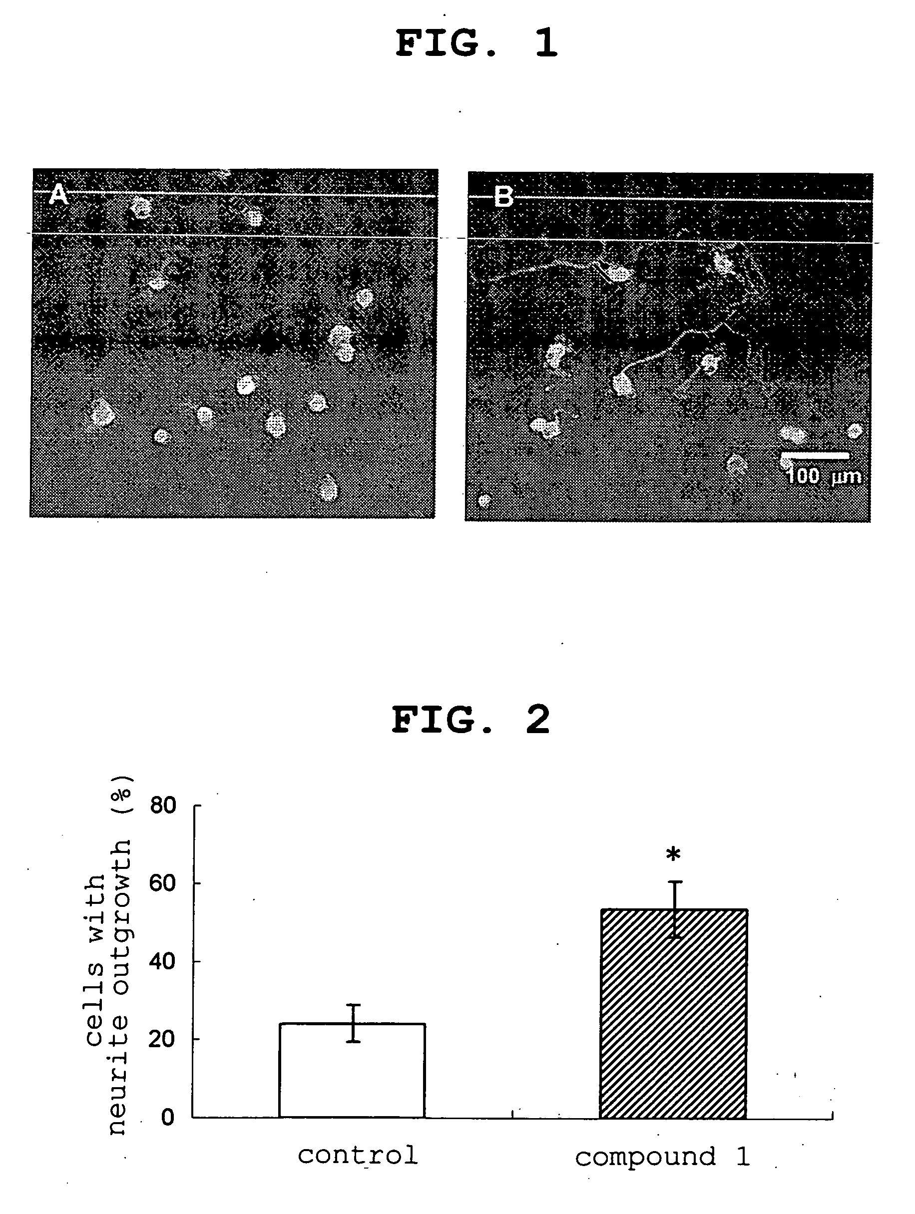 Corneal perception recovery drug containing amide compound