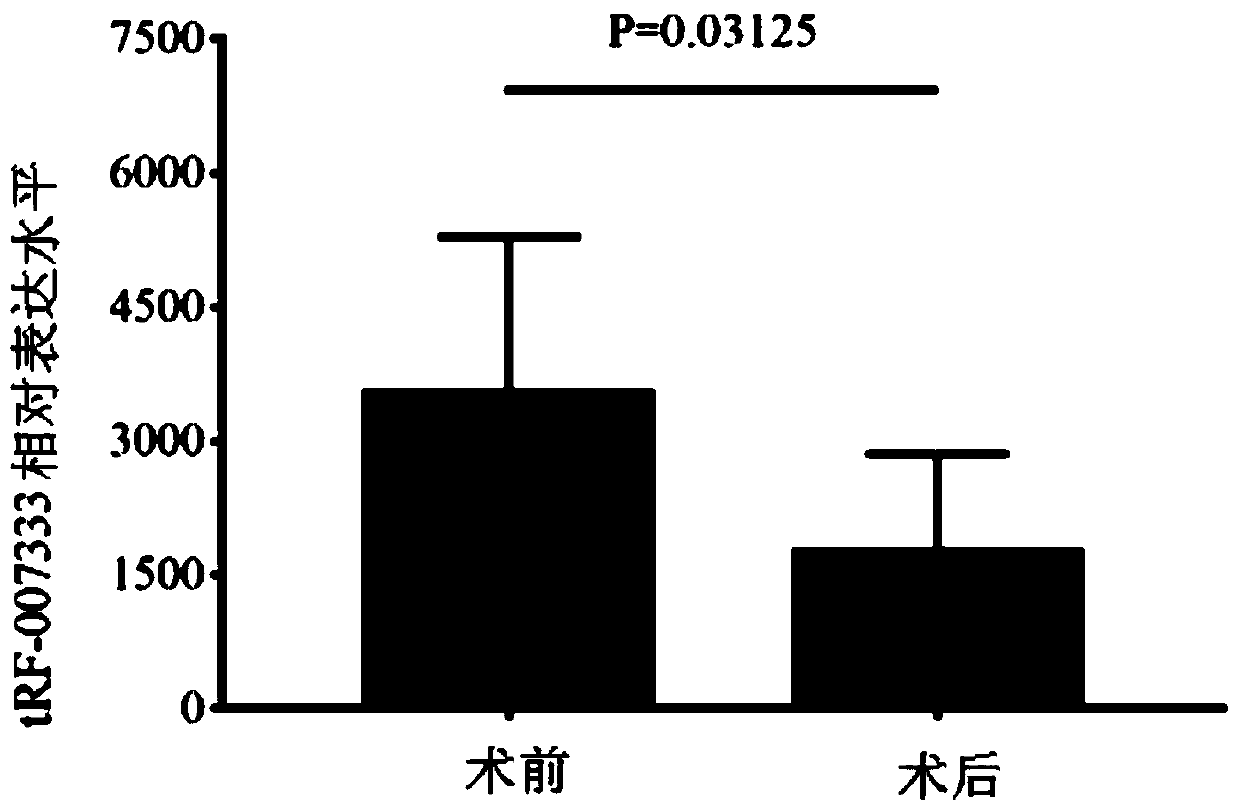 tRNA-derived fragment (tRF) related to non-small cell lung cancer (NSCLC) and application of tRF