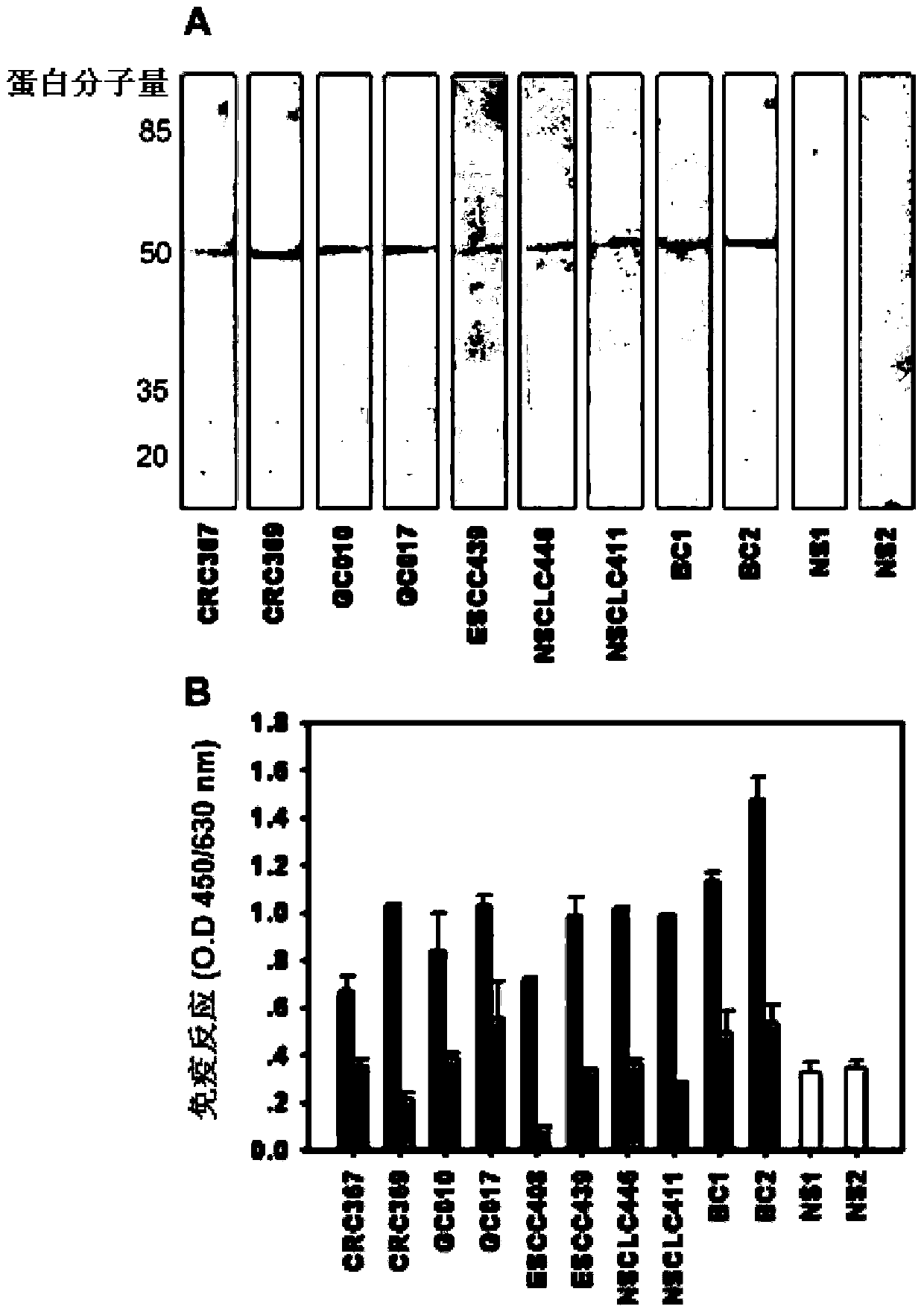 A kind of tumor-specific antigen and its application