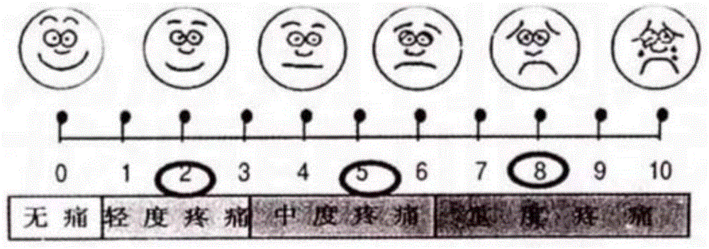 Fecal microbiota capsule, as well as preparation method and application thereof