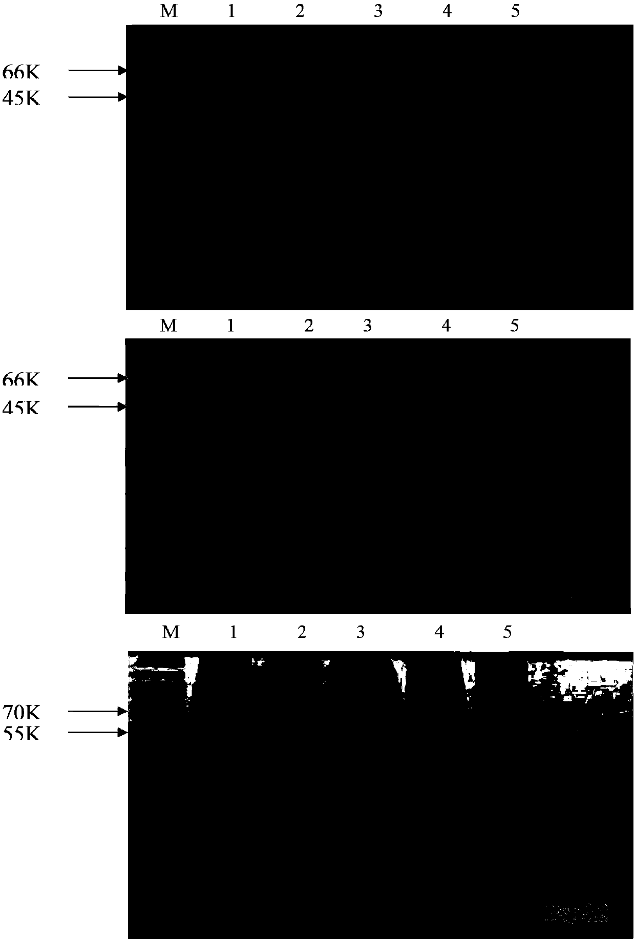 Recombinant proteins PspA1, PspA2 and PspA3, and polysaccharide conjugation vaccine containing the same