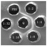 Riemerella anatipestifer OmpA/MotB signal peptide-removal recombinant protein, antibody and preparation method and application thereof