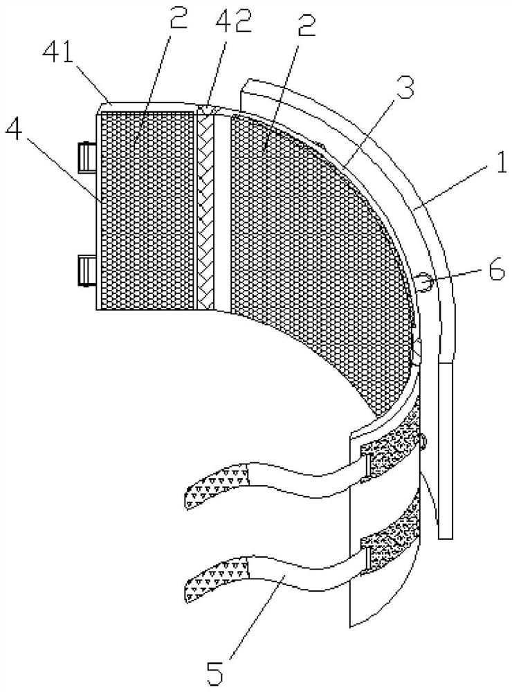 Clinical lung protection device for thoracic surgery department