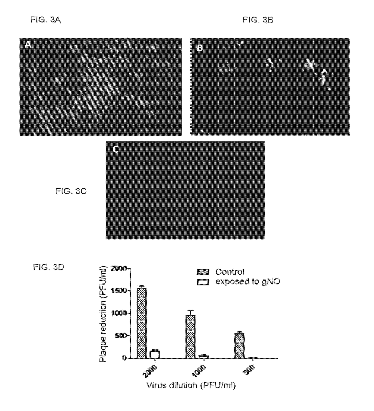 Inhalation of nitric oxide for treating respiratory diseases