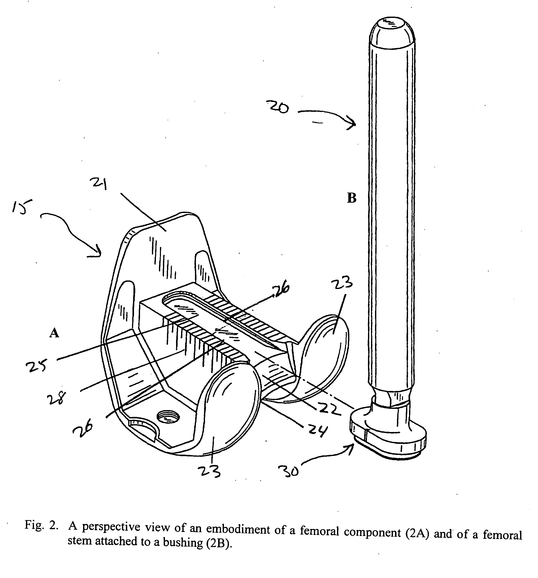 Prosthetic revision knee system