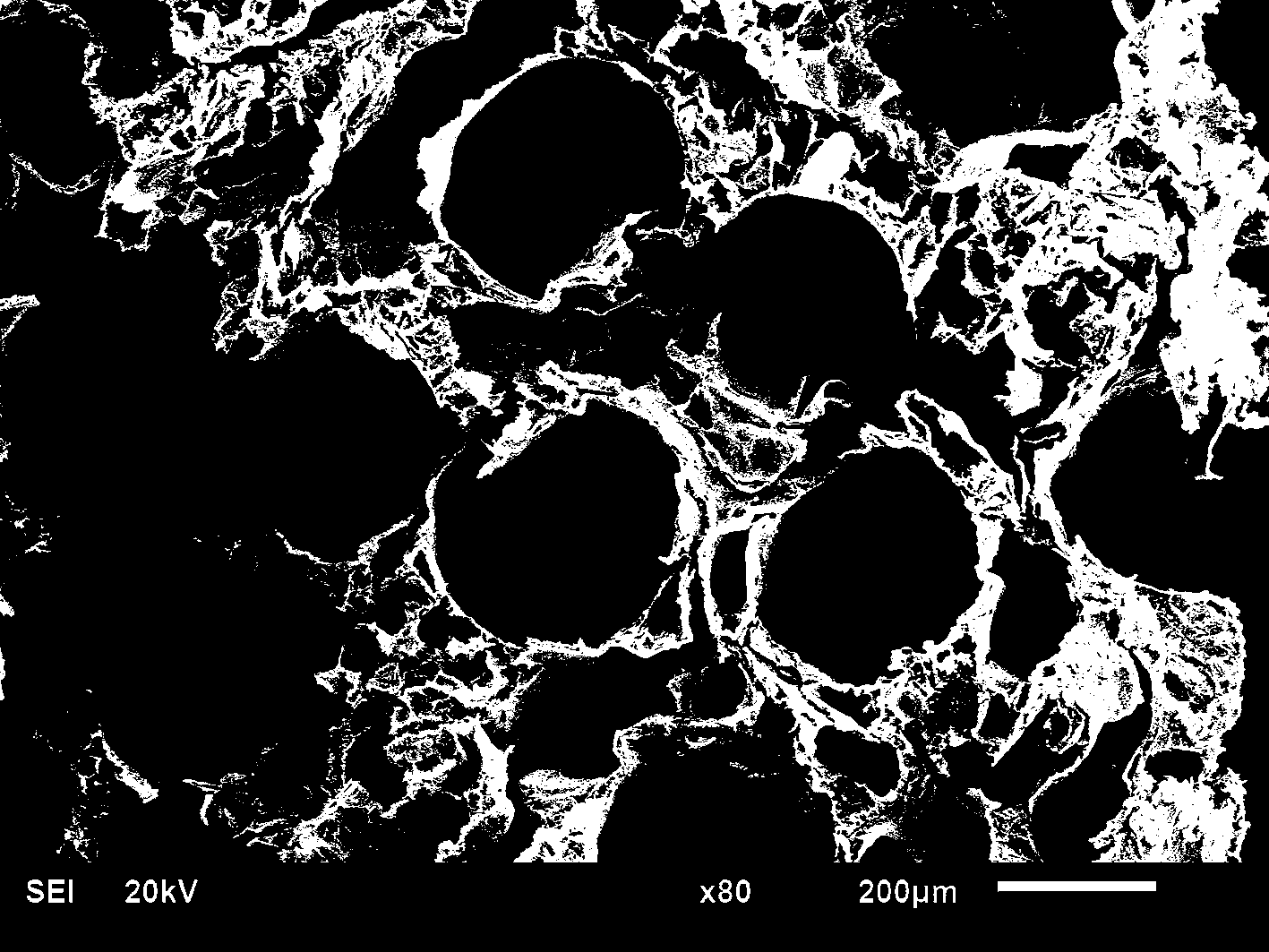 Preparation method of bone repair bracket with osteoid poriform regeneration channel structure