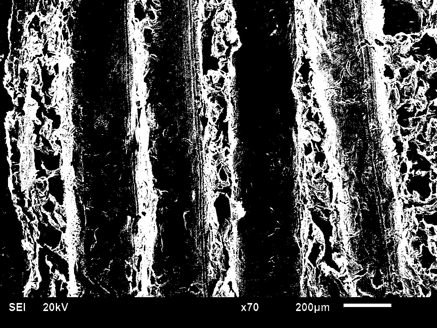 Preparation method of bone repair bracket with osteoid poriform regeneration channel structure